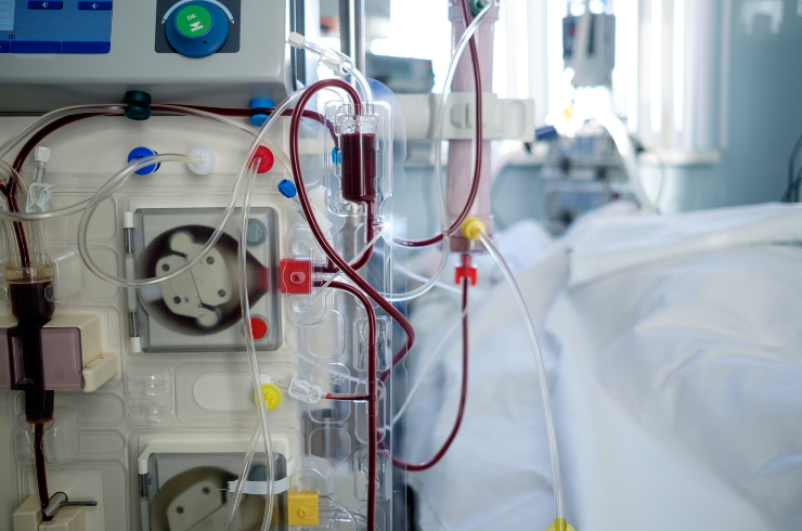 Hemodialysis
